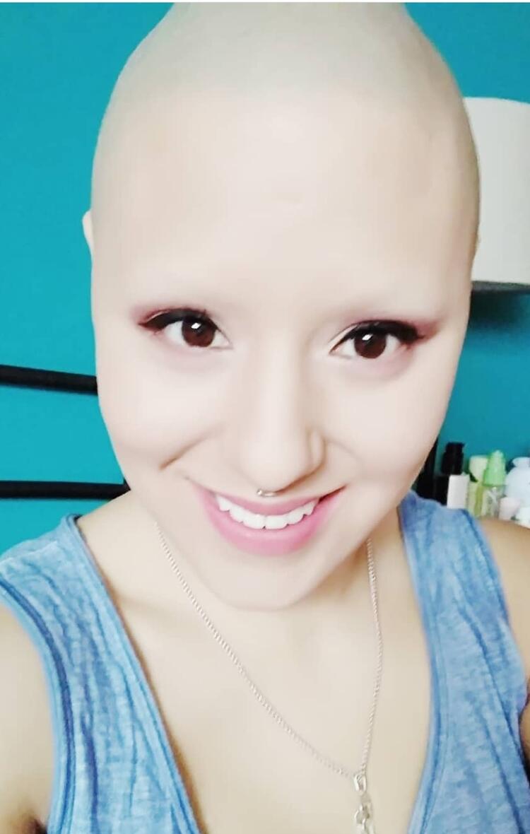 Baldscarmich
