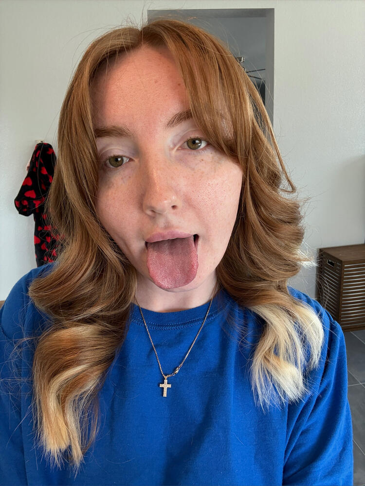 𝐆𝐢𝐧𝐠𝐞𝐫 𝐖𝐢𝐥𝐝𝐞 SINGLE
