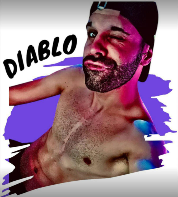 🅳🅸🅰🅱🅻🅾 ♋ 🇮🇹