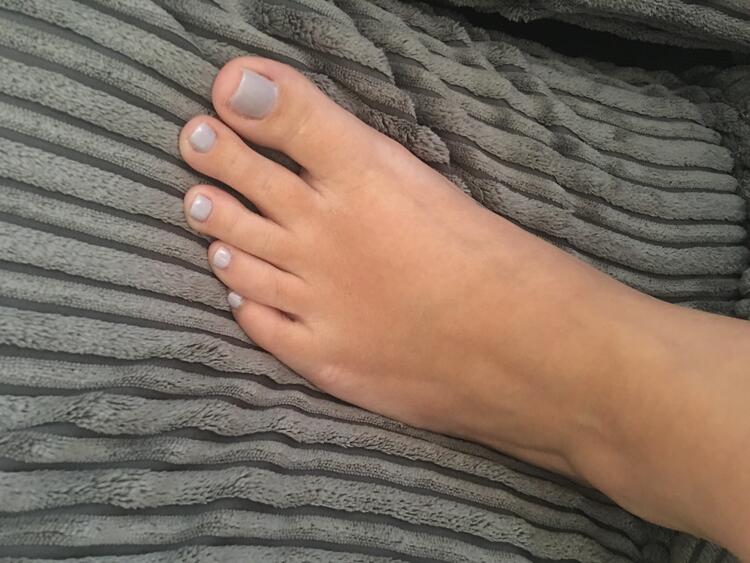 ToetallyFeet